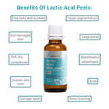LACTIC Acid 90% Skin Chemical Peel- Alpha Hydroxy (AHA) For Acne, Skin Brightening, Wrinkles, Dry Skin, Age Spots, Uneven Skin Tone, Melasma & More (from Skin Beauty Solutions) - 16oz/480ml