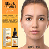 DERMAXGEN Turmeric Face Serum + Vitamin C: Organic Moisturizer for Acne Reduction, Clear Skin Tone, & Anti-Aging Benefits - Hydrate Dull & Dry Skin - Facial Serum - 4 FL OZ