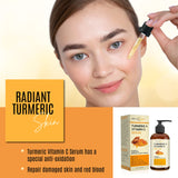 DERMAXGEN Turmeric Face Serum + Vitamin C: Organic Moisturizer for Acne Reduction, Clear Skin Tone, & Anti-Aging Benefits - Hydrate Dull & Dry Skin - Facial Serum - 8 FL OZ