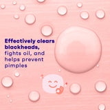 CLEAN & CLEAR Essentials Oil-Free Deep Cleaning Face Astringent with 2% Salicylic Acid Acne Medication for All Skin Types, Facial Astringent to Treat & Help Prevent Pimples, 8 fl. oz