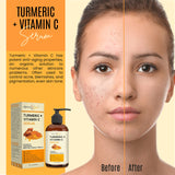 DERMAXGEN Turmeric Face Serum + Vitamin C: Organic Moisturizer for Acne Reduction, Clear Skin Tone, & Anti-Aging Benefits - Hydrate Dull & Dry Skin - Facial Serum - 8 FL OZ