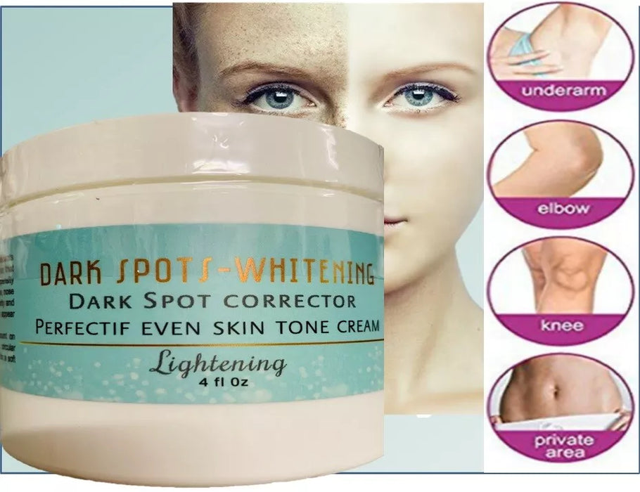 Whitening cream dark skin 4 fl oz bleaching cream support skin