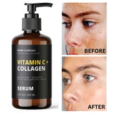 DEMA CLINICALS Vitamin C serum + Collagen, Skin Brightening, Anti aging, Wrinkles SERUM - 4oz