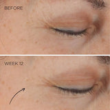 Elizabeth Arden Retinol Ceramide Capsule Serum, Night Skin Care, Fine Line and Wrinkle Erasing Face Serum, 60 Count