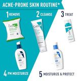 Retinol Serum for Post-Acne Marks and Skin Texture | Pore Refining, Resurfacing, Brightening Facial Serum with Retinol and Niacinamide | Fragrance-Free, Paraben Free & Non-Comedogenic| 1 Oz