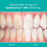 Opalescence 20% Teeth Whitening Refill Kit (2 Packs / 4 Syringes) Carbamide Peroxide. Made by Ultradent, in Mint Flavor. Tooth Whitening Refill Syringes - B-5196-4