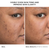 IT Cosmetics Bye Bye Dark Spots 4% Niacinamide Serum - Visibly Reduces Dark Spots & Improves Skin Clarity In 8 Weeks - With 1% Ethyl Vitamin C - For All Skin Types - 1 fl oz