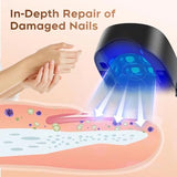 Nail Fungus Laser Treatment Device, FSA or HSA eligible Home Use Laser Toenail Fungus Treatment Device, Elderly Easy to Use Toenail Fungus Laser Onychomycosis Treatment for Thickened Yellowed Nails