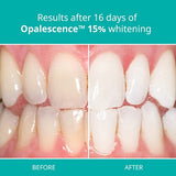 Opalescence Teeth Whitening Kit - Gel Syringes 15% - Low Sensivity (2 Packs / 4 Syringes) - Fluoride, Carbamide Peroxide - Made in The USA by Ultradent 5195-2