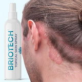 BRIOTECH Hypochlorous Acid Spray, Topical Skin Face & Body Mist, Support Irritations, Soothe Redness, Dry Skin & Scalp, Athletic Itch, Packaging May Vary