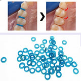 DentSmile 1000pcs/bag Dental Orthodontic Separator Bulk Pack Elastic Orthodontic Separate Ties