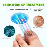 Nail Fungus Laser Treatment for Toenails, FSA or HSA eligible Highly Effective Blue Light Laser Therapy to Treat Onychomycosis, Revolutionary Nail Fungus Treatment, Easy to Use at Home, Elderly