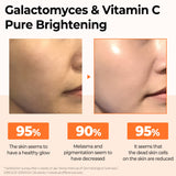 SOME BY MI Galactomyces Pure Vitamin C Glow Serum - 1.01 Oz, 30ml - Daily Brightening Care Korean Vitamin C Serum for Face Glass Skin - Improvement of Skin Texture and Elasticity - Korean Skin Care