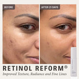 SHANI DARDEN SKINCARE Retinol Reform Anti-Aging Face Serum, Helps Reduce Fine Lines, Wrinkles, and Texture with Minimal Irritation, 0.34 fl oz