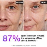 The INKEY List 1% Slow Release Retinol Serum, Targets Wrinkles and Signs of Ageing 30ml, 1 fl oz